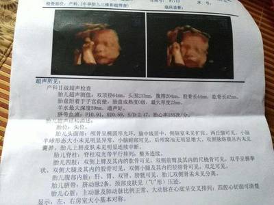 胎儿七个月双顶径标准