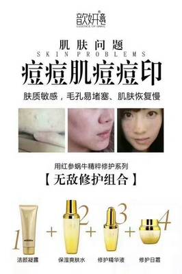 痘痘肌用后的哪个系列