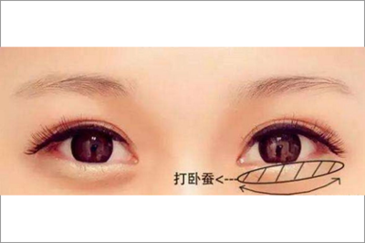 小宝宝卧蚕眼图片