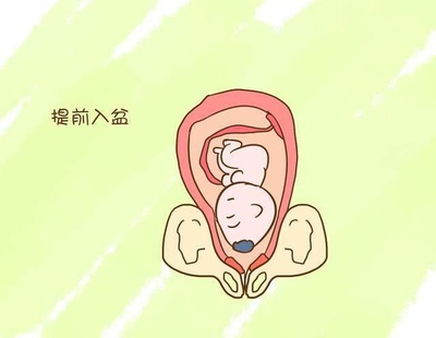 胎儿一直不入盆怎么办