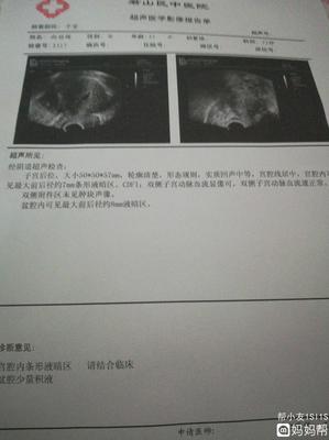 宫腔积血是怎么回事