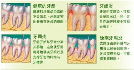 口腔出血是什么原因