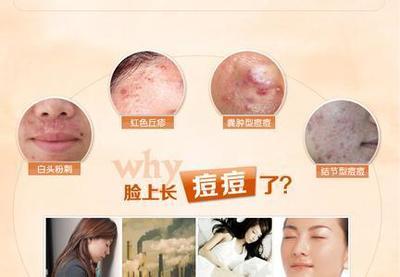 如何不容易长痘痘