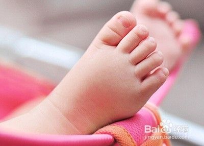 宝宝老是搓脚怎么回事
