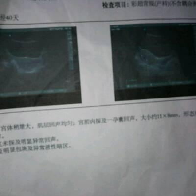 怀孕40天能看出男女吗