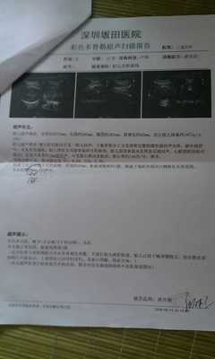 孕妇需要做心脏彩超吗