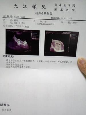 怀孕四十五天有什么反应