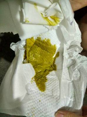 宝宝拉绿便怎么办