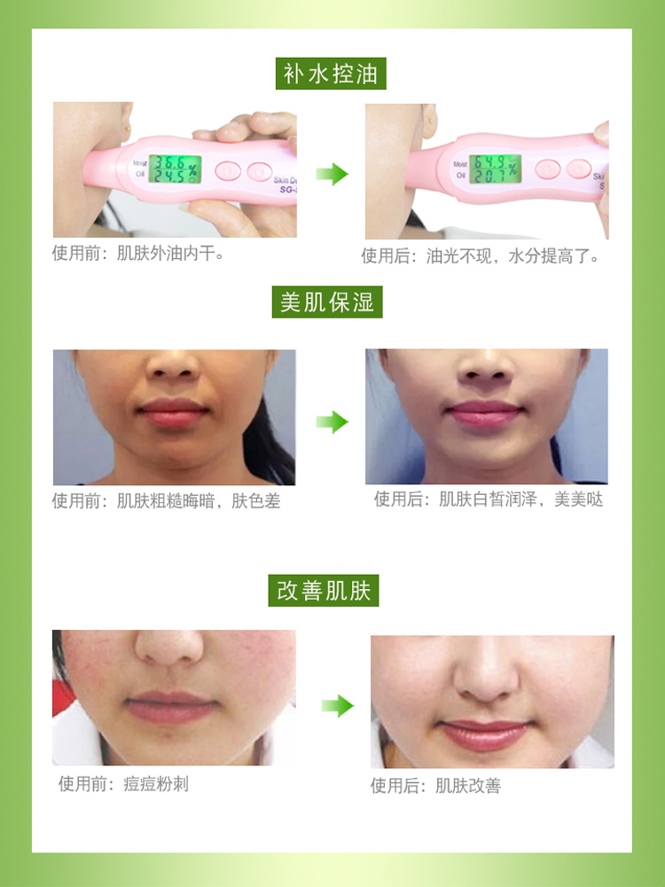 痘痘肌可以用丝瓜原液