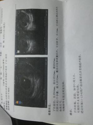 怀孕流褐色血