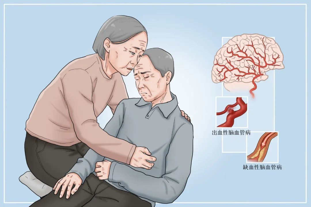 脑血管有问题怎么治疗