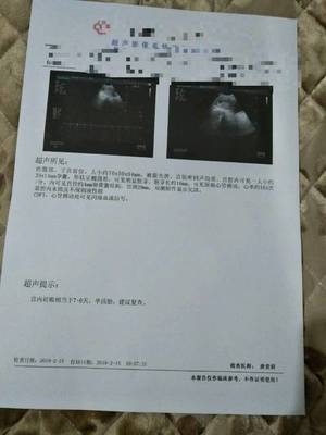 怀孕第一个月有月经吗