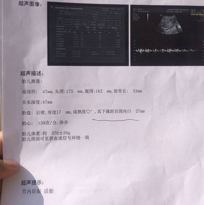 怀孕五个月绕颈一周怎么办
