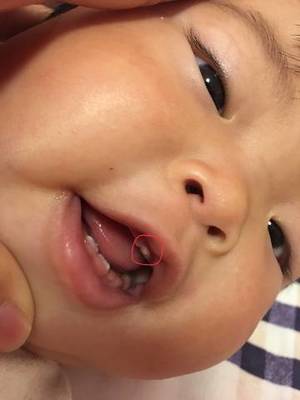 7个月宝宝还没长牙正常吗