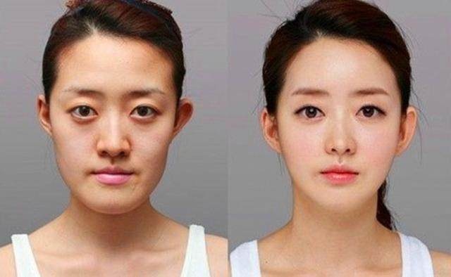 整容脸部