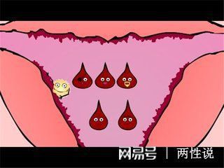经血呈褐色是怎么回事