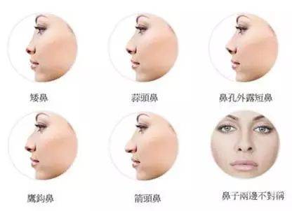 圆头鼻子的女人的面相