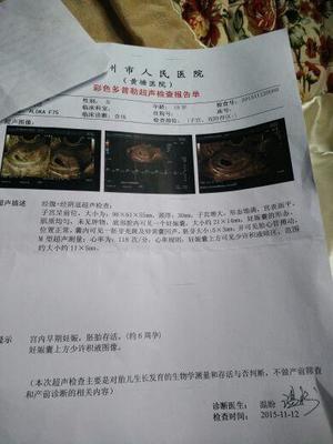多囊怀孕