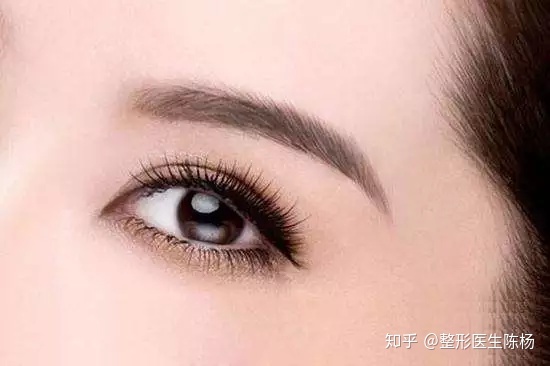 35岁割双眼皮
