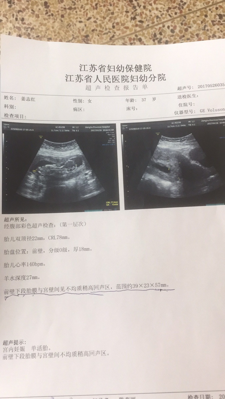 怀孕十四周胎儿有多大