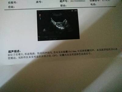 怀孕会分泌白带吗