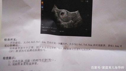 孕妇肾盂分离是什么意思