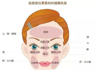 痘痘位置与健康