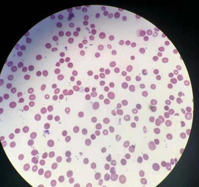 红细胞分析多少钱