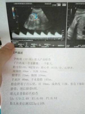 多少周估算胎儿体重
