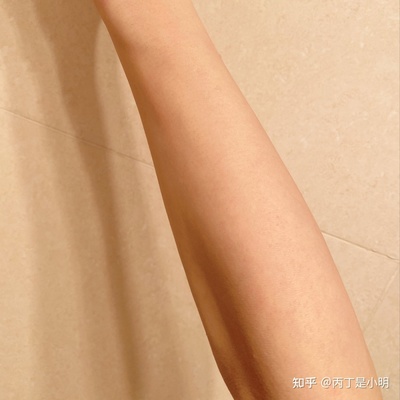 腋下有斑点是怎么回事