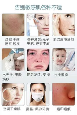 水光针后脱皮正常吗