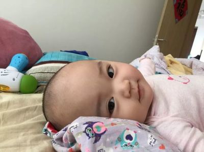 新生儿眼底