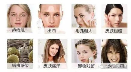严重痘痘遮瑕