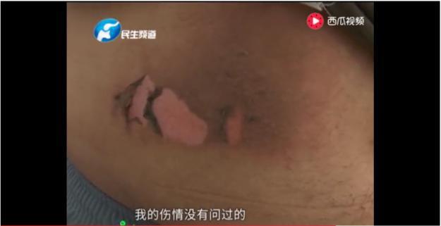苹果手机充电头爆炸充电手机很烫是怎么回事?
