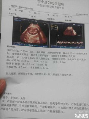 胎儿畸形能检查出来吗