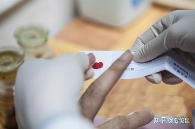 亲子鉴定多久出结果