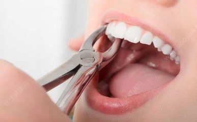 小孩怎么拔牙
