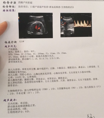 胎儿侧脑室宽的发生率有多少钱