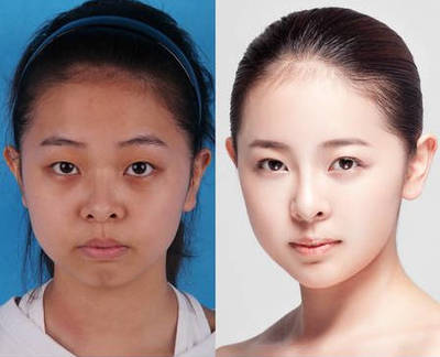 双眼皮做美瞳线好看吗