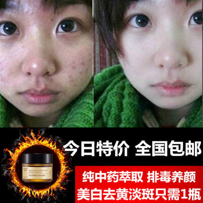 中药收缩毛孔面膜