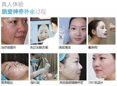 女人打水光针和不打的区别