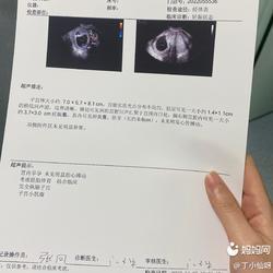 怀孕两个月能做吗