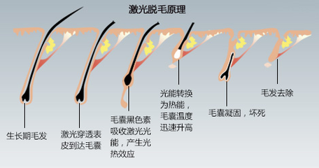 什么能转化为激光