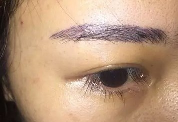 半永久眉毛失败案例