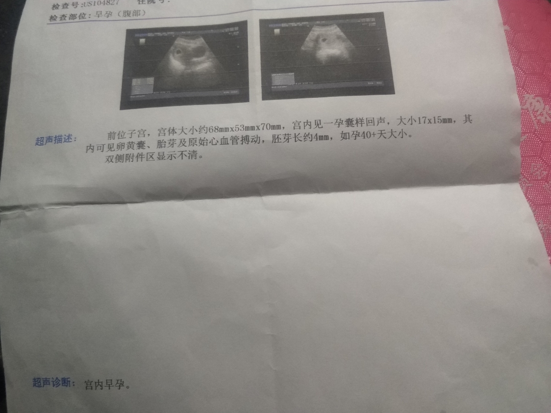 怀孕8周胎儿图片欣赏