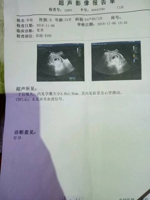 怀孕2个月最准看男女