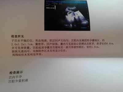 怀孕多久可以验血确认