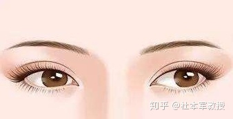 什么年龄双眼皮