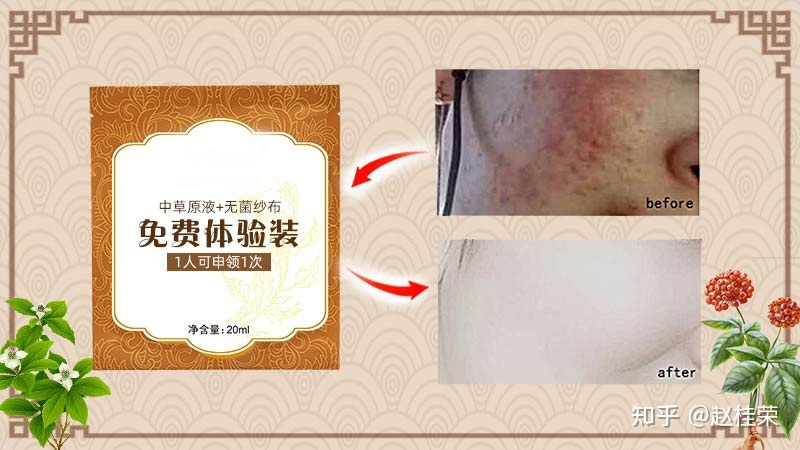 宝宝脸发红发烫怎么回事