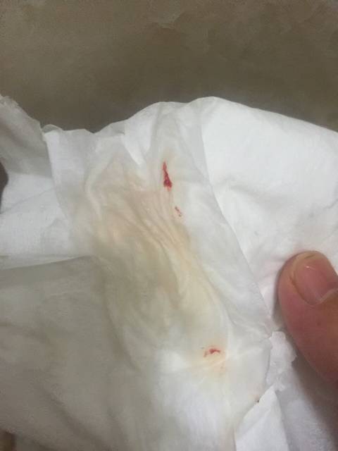 怀孕的人梦见自己见红